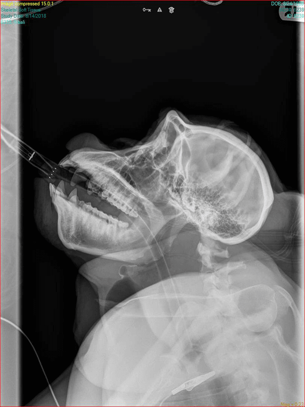 Animal X-Rays: An Inside Look - Lincoln Park Zoo Animal X-Rays: An Inside Look - Lincoln Park Zoo